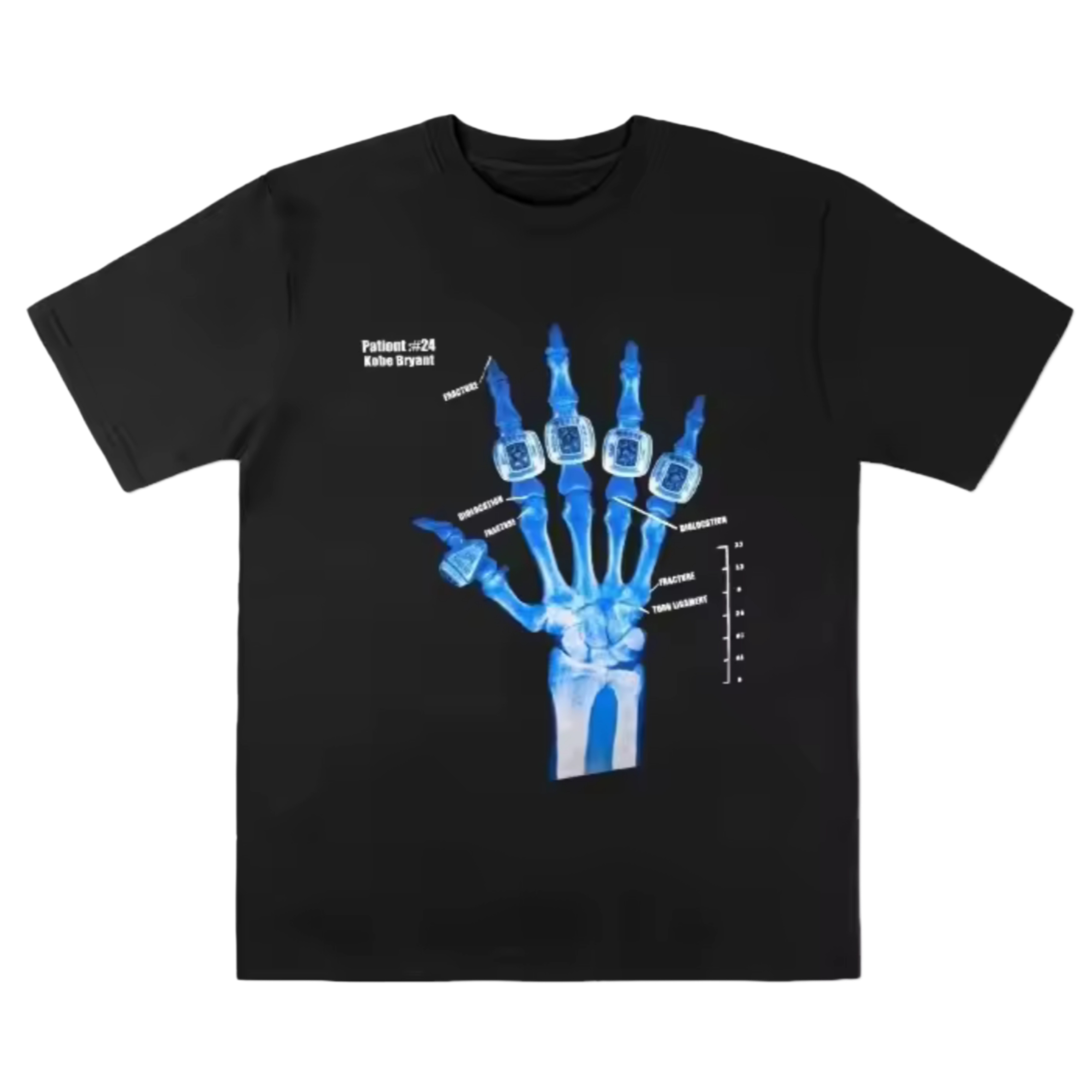 Iced X-Ray Graphic Tee
